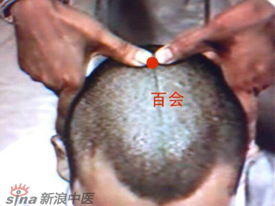 艾灸常用的保健穴有哪些？--百會(huì )