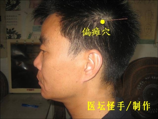 王文遠平衡針灸穴位圖 - 3396815 - 3396815博愛(ài)