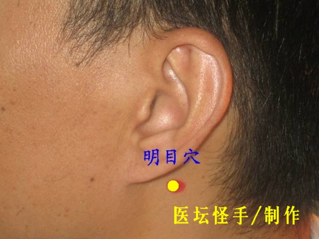 王文遠平衡針灸穴位圖 - 3396815 - 3396815博愛(ài)