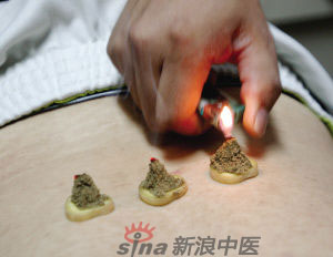 灸法的種類(lèi)  你知道多少？