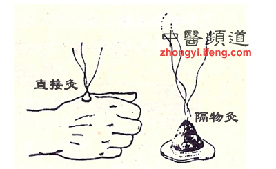 點(diǎn)擊將在新窗口查看全圖 溫補脾胃用艾灸 男女老少都適用