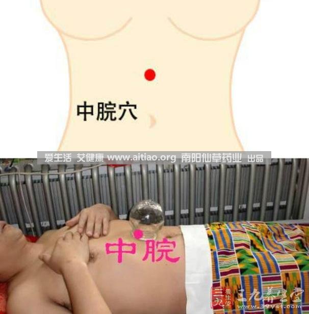 中脘穴位于腹部正中線(xiàn)，臍上4寸的位置上。每天艾灸10-15分鐘，能有效緩解胃部不適的癥狀，同時(shí)有助于祛濕。