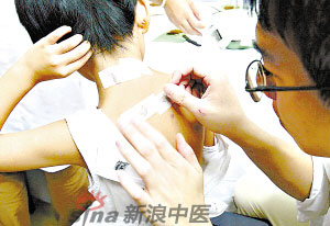 灸法的種類(lèi)  你知道多少？